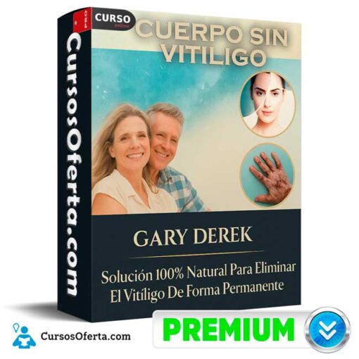 Cuerpo sin vitiligo de Gary Derek 12 Cuerpo sin vitiligo de Gary Derek cuerpo sin vitiligo de gary derek 694e3fb44667e